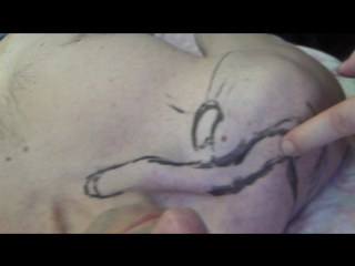 anatomy and biomechanics of the shoulder girdle part 4