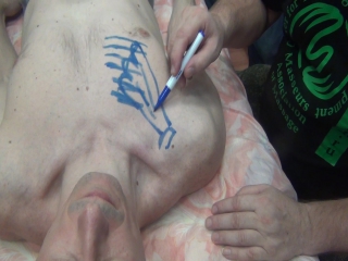 anatomy and biomechanics of the shoulder girdle part 11