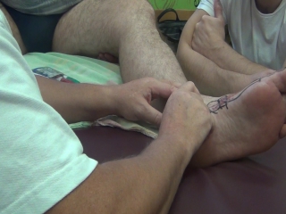 biomechanical correction of the foot day 2. part 3