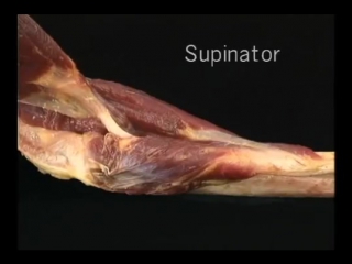 acland video atlas. upper limb