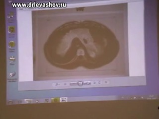 levashov. thoracic-abdominal diaphragm.
