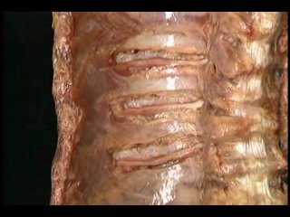 video atlas of human anatomy muscles of the neck spine