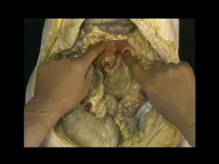 video atlas of anatomy acland. movie 6 in full. internal organs