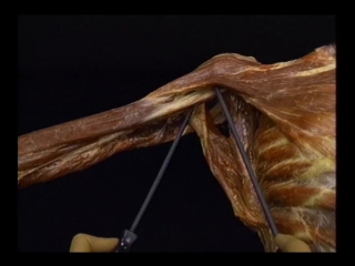 video atlas of anatomy acland. full movie 1.