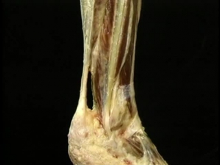 video atlas of anatomy acland. film 2, part 3. calf and ankle. russian dub by a. pilyugin.